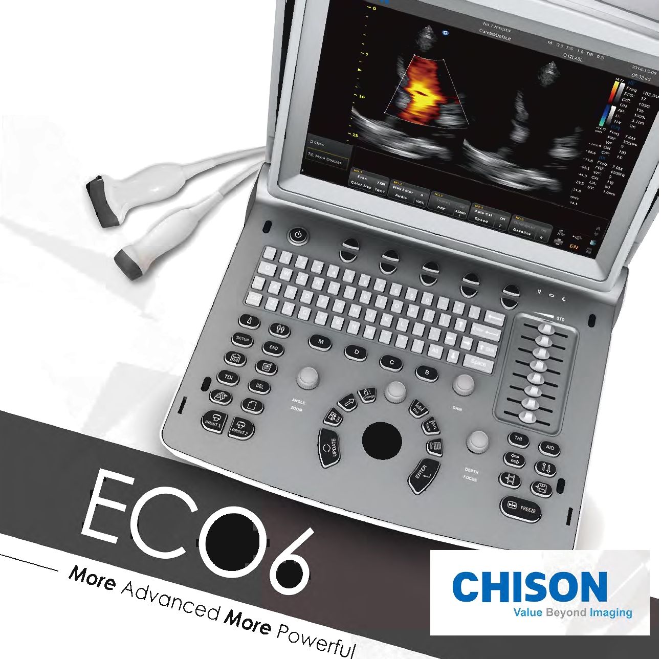 Máy siêu âm xách tay Chison ECO 6